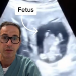 fetus in liver