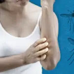 mosquitoes naturally