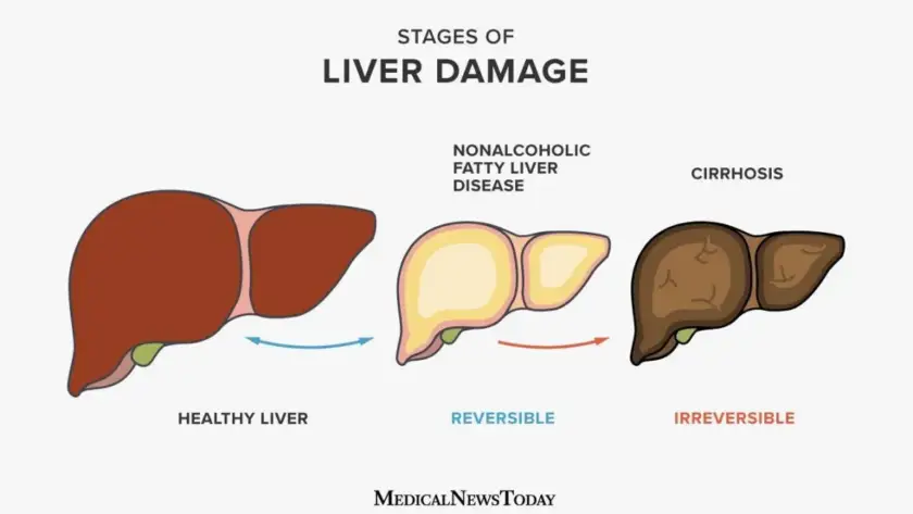 liver